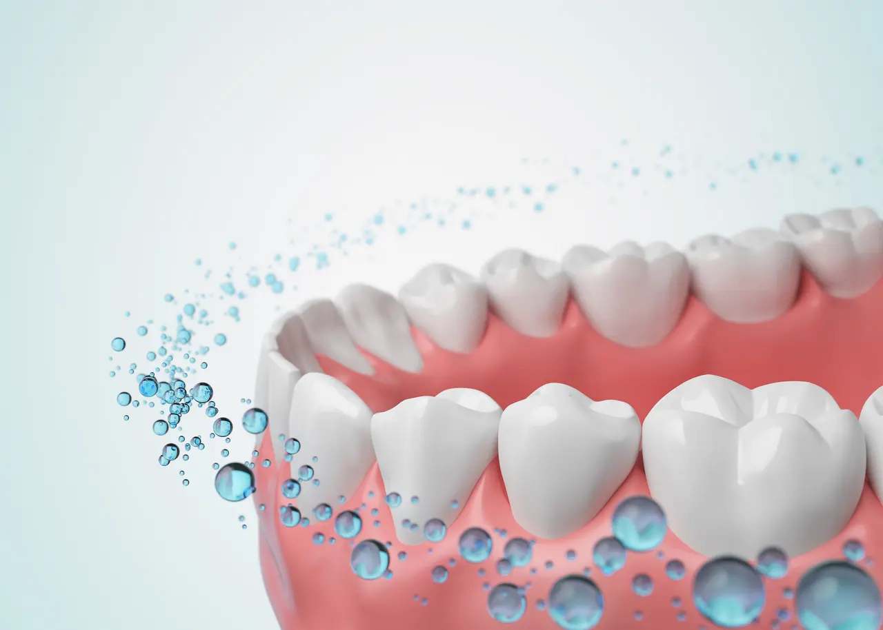 Fluoride Treatments at Terrell Hills Dental in San Antonio