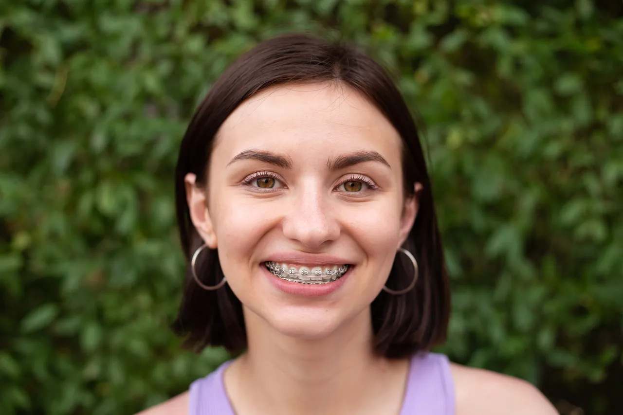 Traditional Braces at Terrell Hills Dental in San Antonio