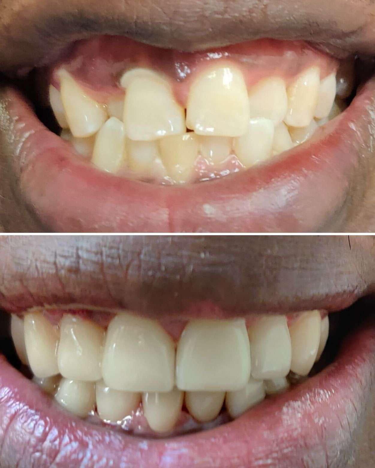 Cosmetic Dentistry San Antonio