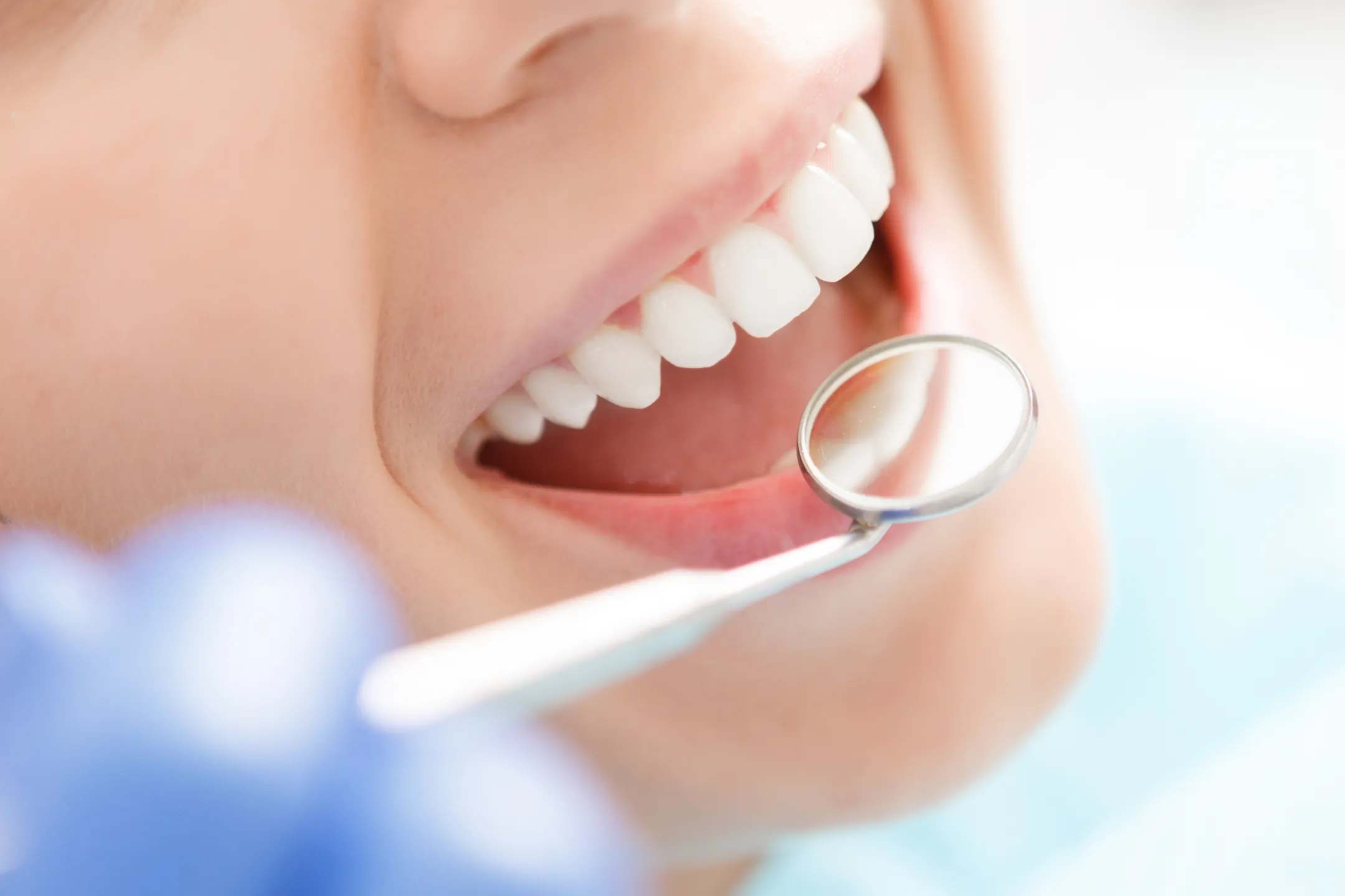 Smile Makeover at Terrell Hills Dental in San Antonio