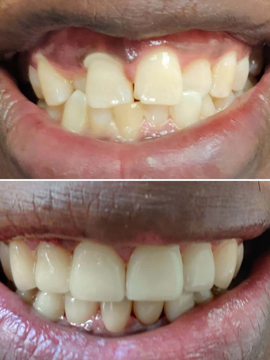 Cosmetic Dentistry at Terrell Hills Dental in San Antonio